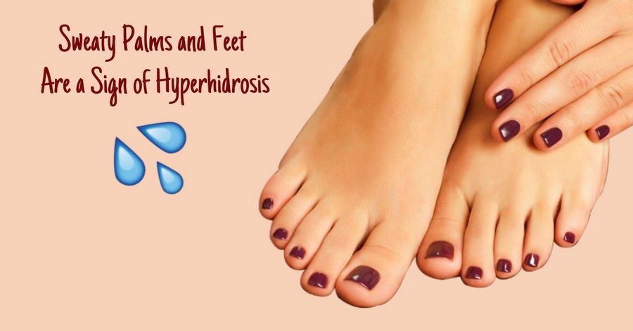 sweaty-palms-and-feet-are-a-sign-of-hyperhidrosis